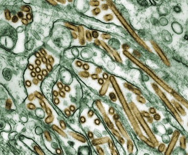 This is a colorized picture of a flu virus.