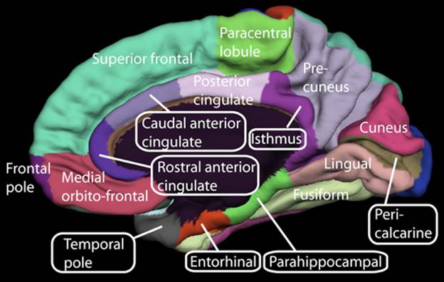 A colorful brain