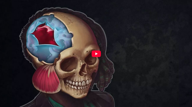 Subdural hematoma operation