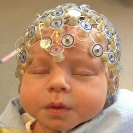 An infant's electrodes cap