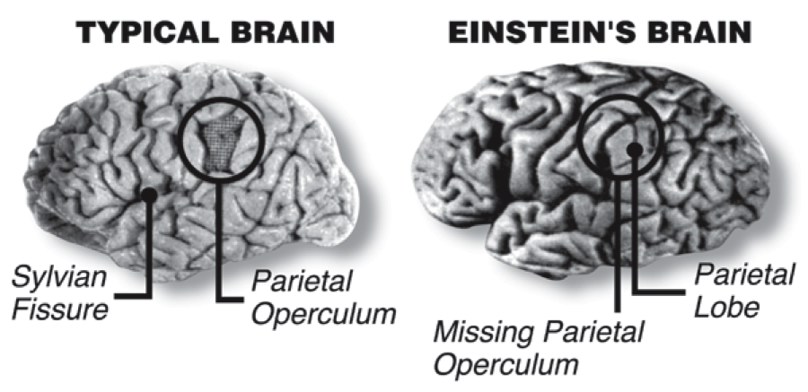 This may be one of the reasons that Einstein was a genius.